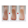 MBeauty Exfoliating Magic Foot - Melora